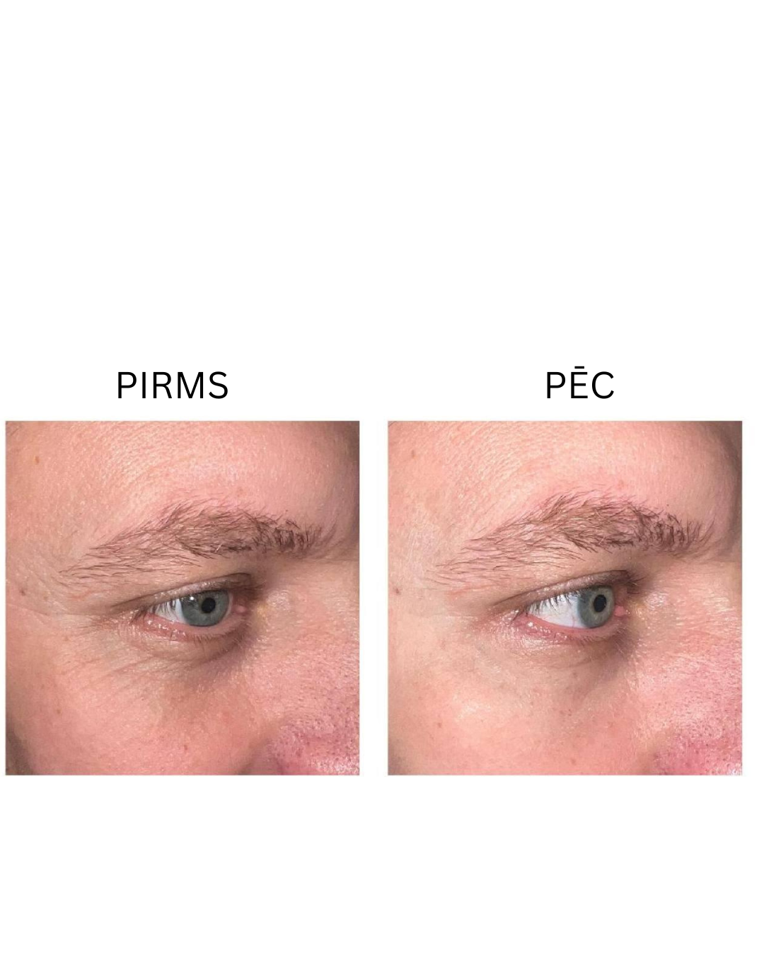 Peptilux "Shock Action" acu kontūru krēms